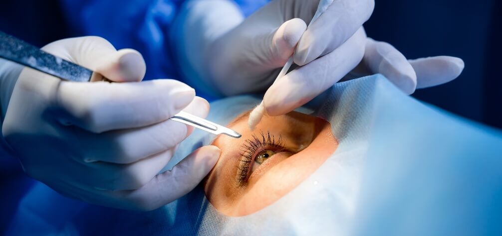 orbit oculoplasty eye surgery